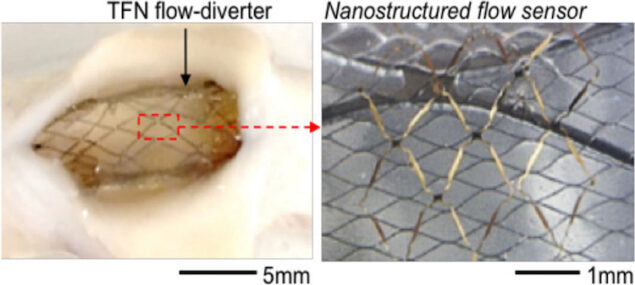 Nanostructured flow-diverter system